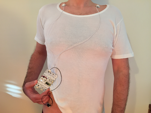 Picture of BITalino ECG placement