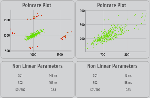 Pointcaré plot