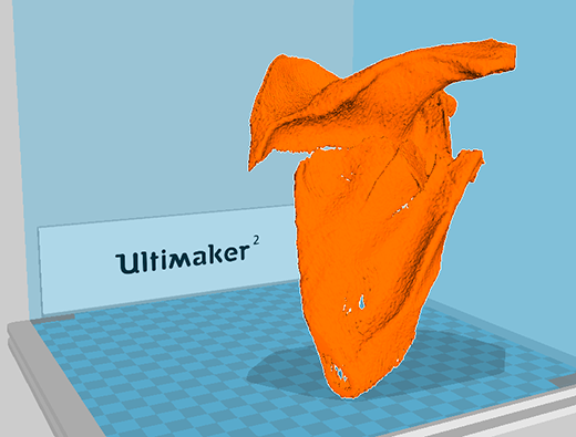 Cura screenshot of scapula