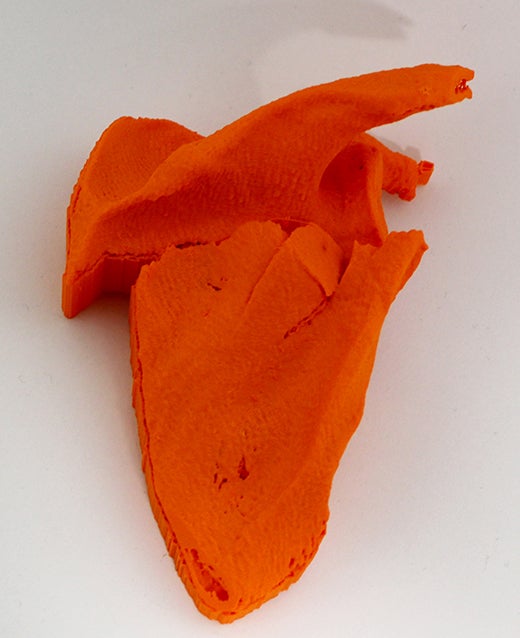 3D printed scapula